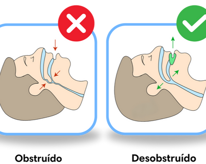 SILENT PRO® | ANTIRONQUIDO