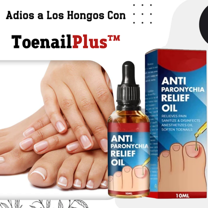 Tratamiento para eliminar Hongos de uña 100% Natural🍃